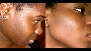 Savon Collagène Réparateur