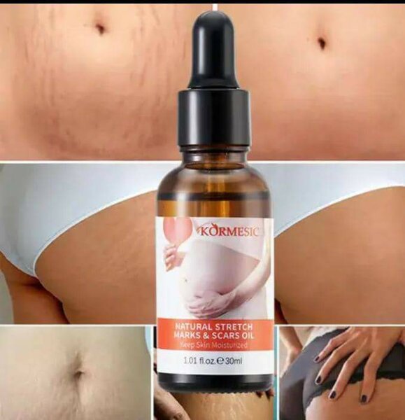 Huile pour vergetures.