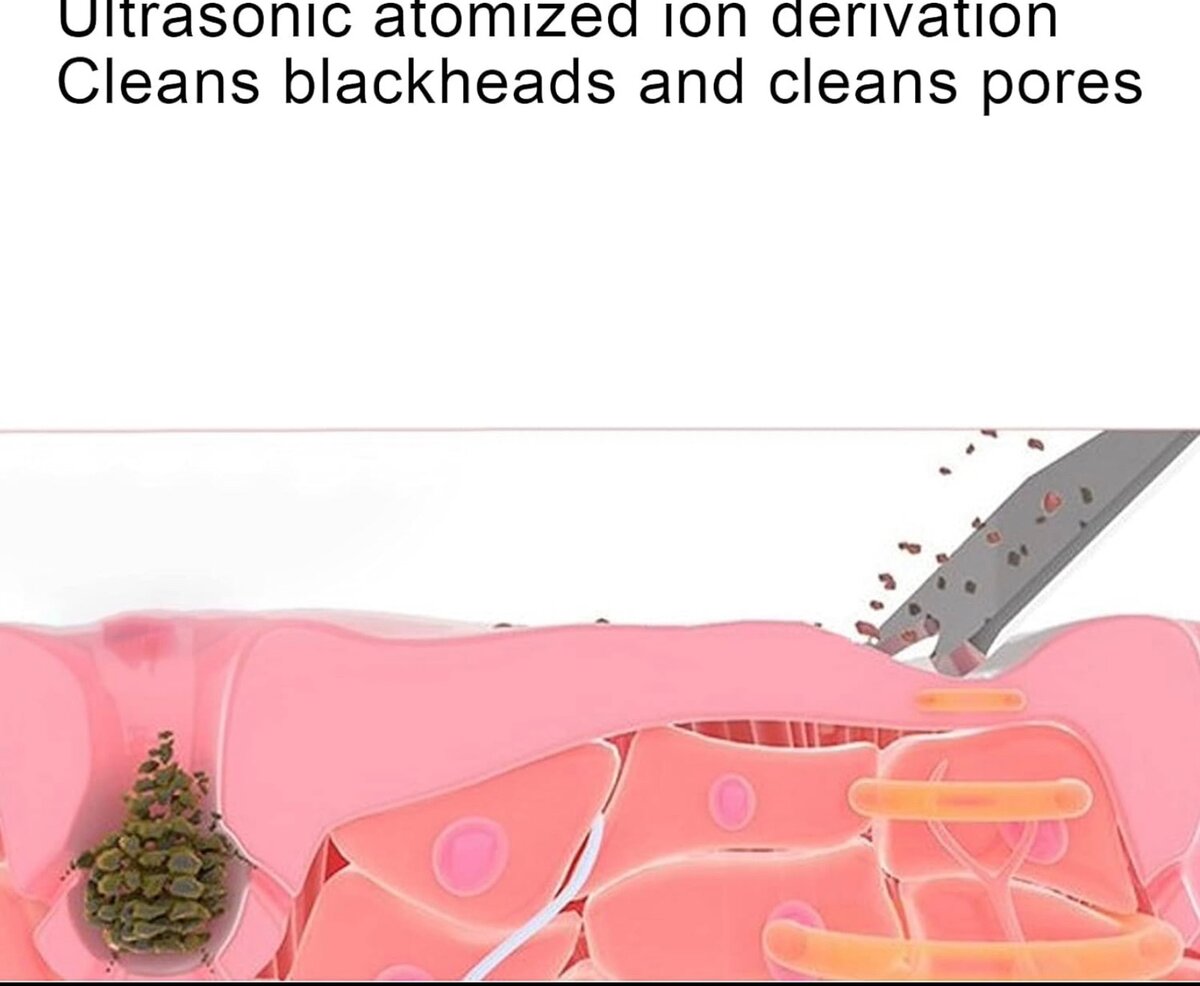 Épurateur de Peau, épurateur de Peau à Ultrasons Dissolvant