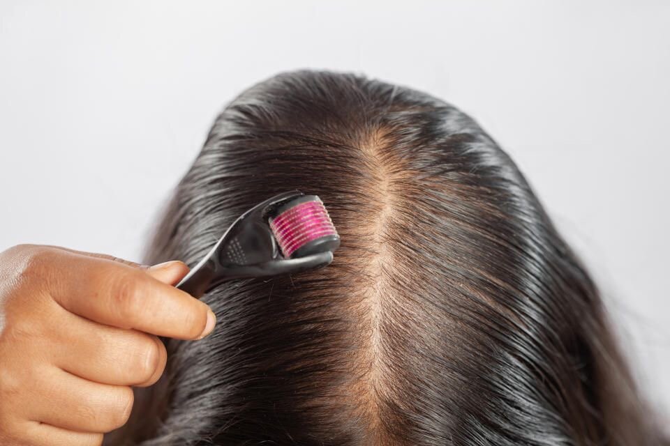 Derma Roller Microneedling
