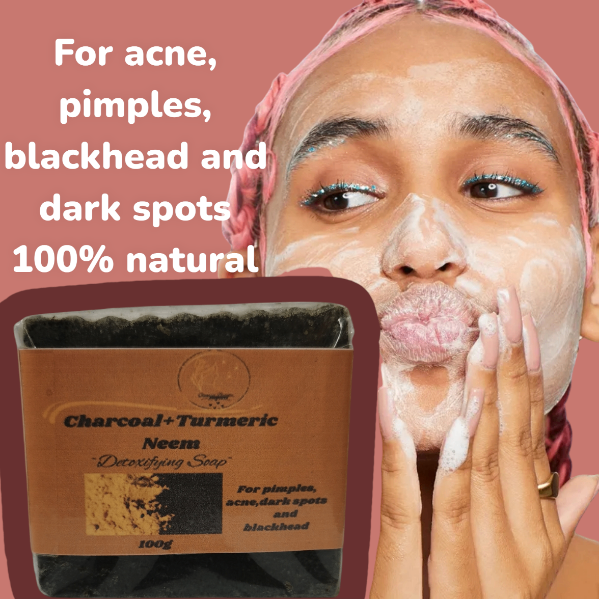 Anti-acne soap