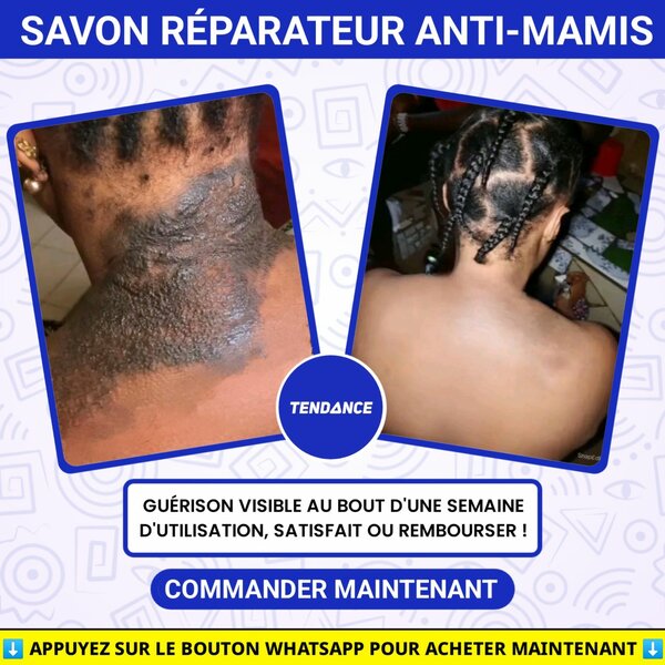 Savon Réparateur Anti-Mamis