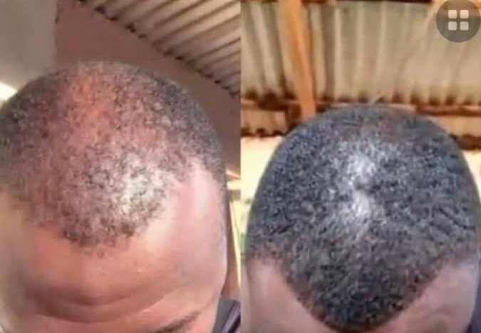 Huile à Barbe Rapide