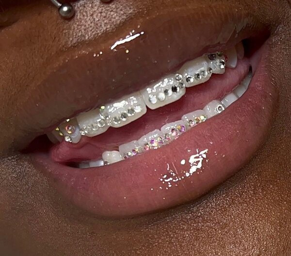 Tooth gems