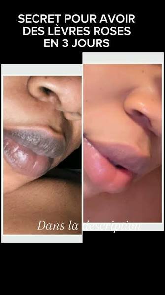 Baume pour Lèvres Roses