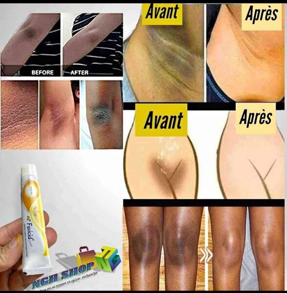 Tubes et savons