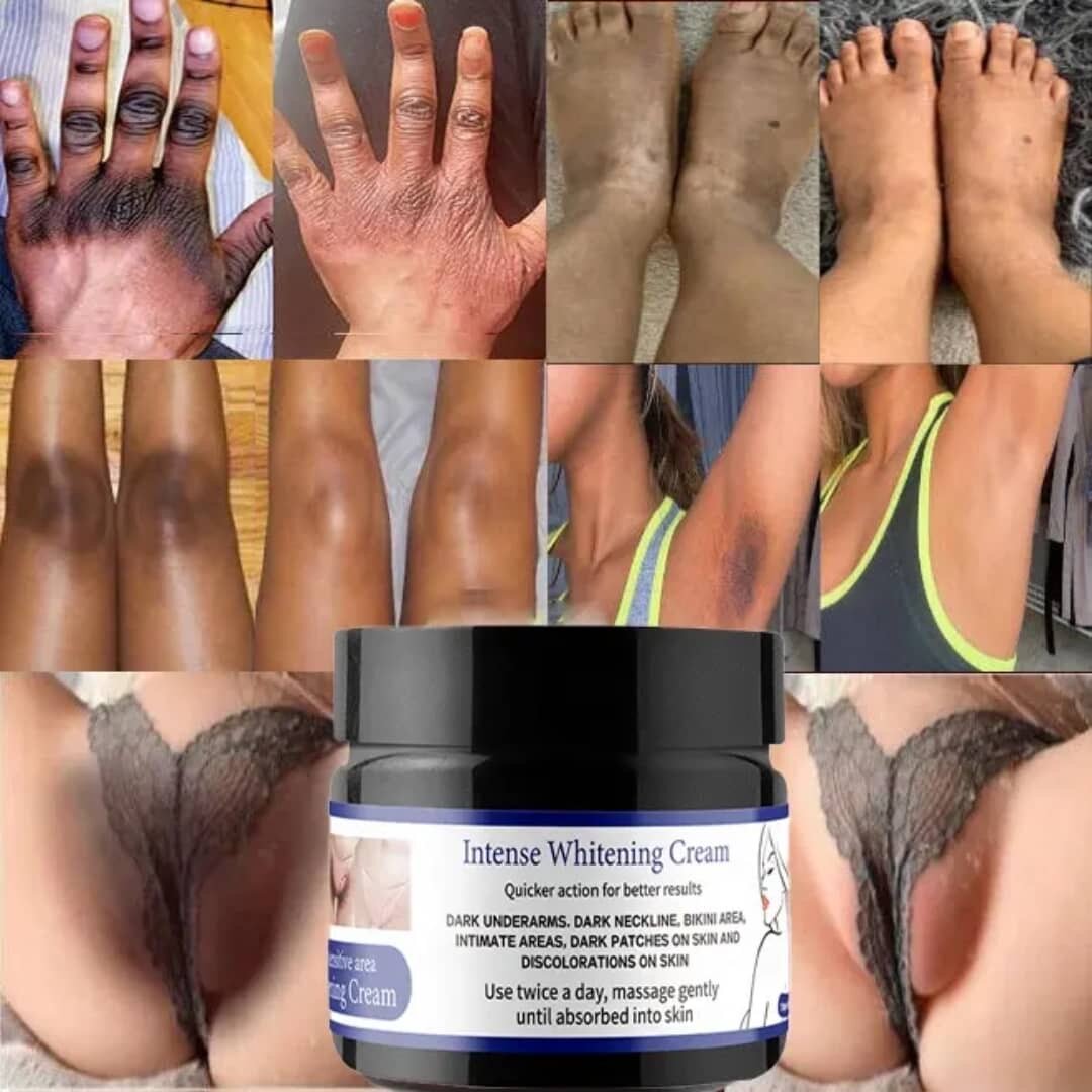 Crème Blanchissante Intense