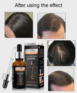 Huile Essentielle Croissance Cheveux