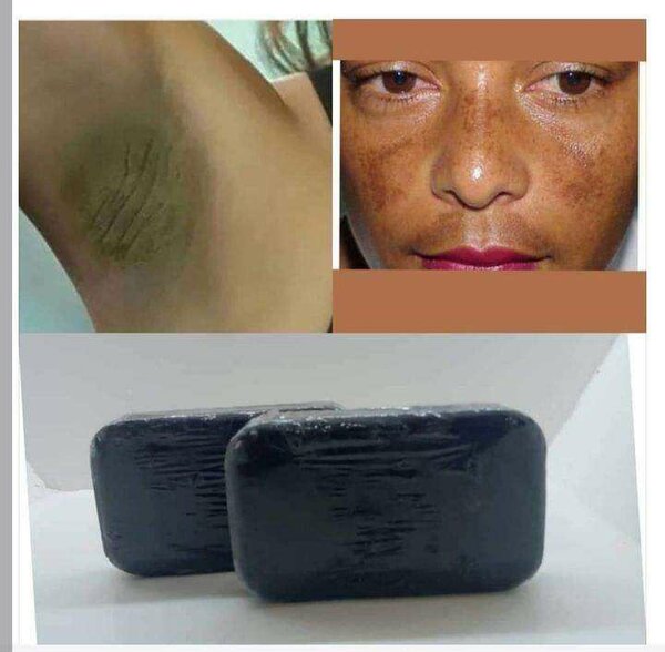 Savon Chelsea, lotion peeling quinto