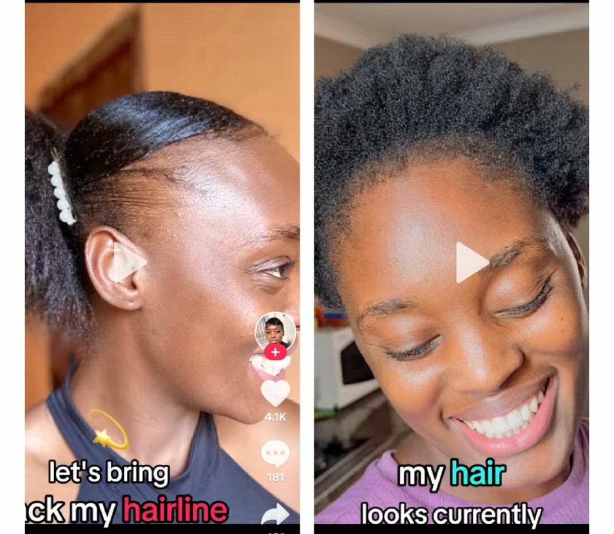 Dermastamp Résultat Rapide