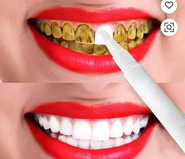 Stylo de blanchiment des dents