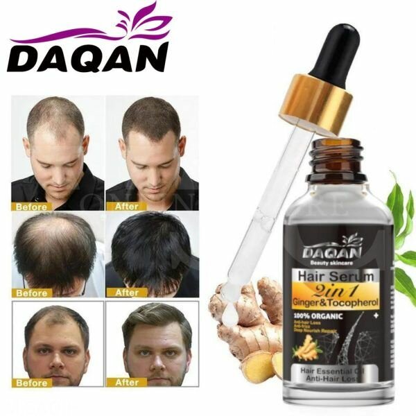 Anti hair Loss serum