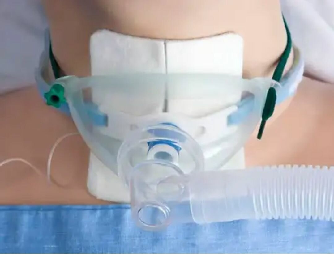 Tracheostomy Tube Holder/Tie