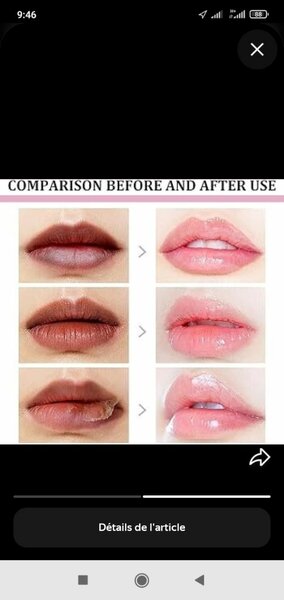 Gommage Lèvres Rose Réparateur