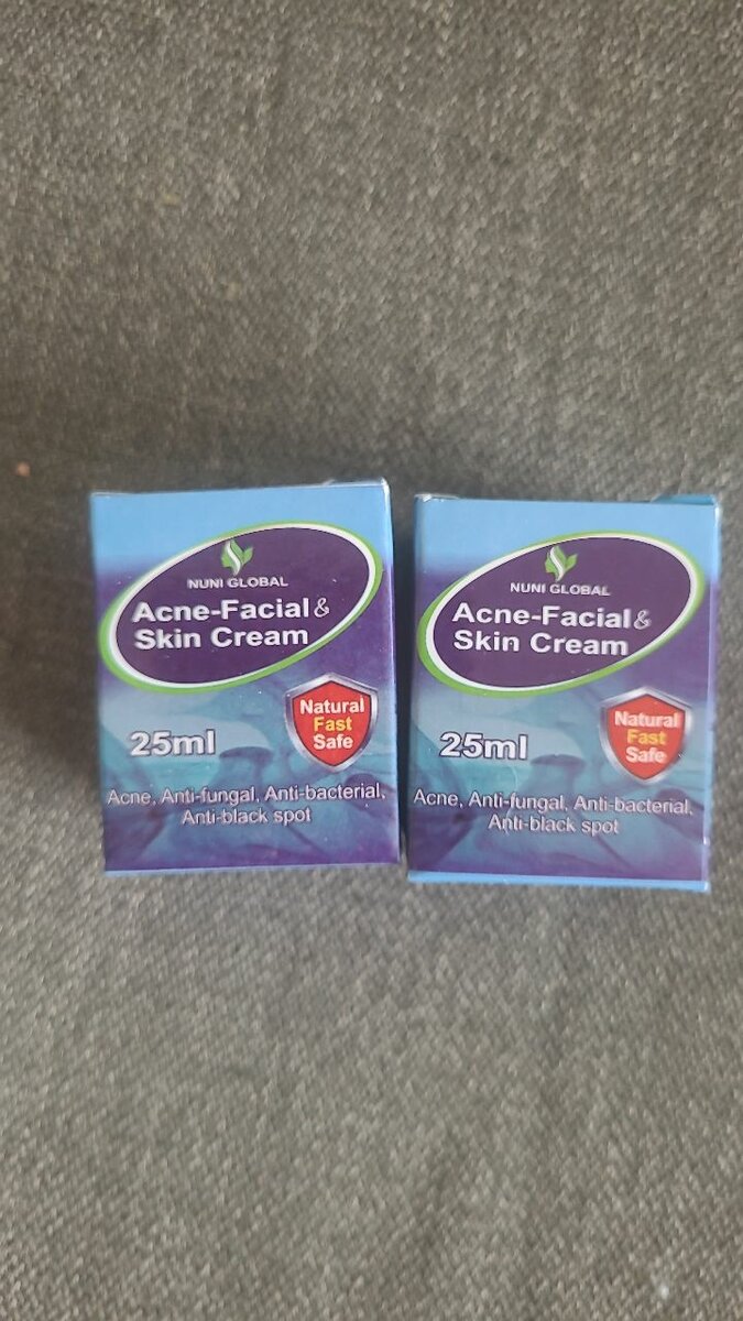 Nuni Global Acne Cream and Cocoa Butter
