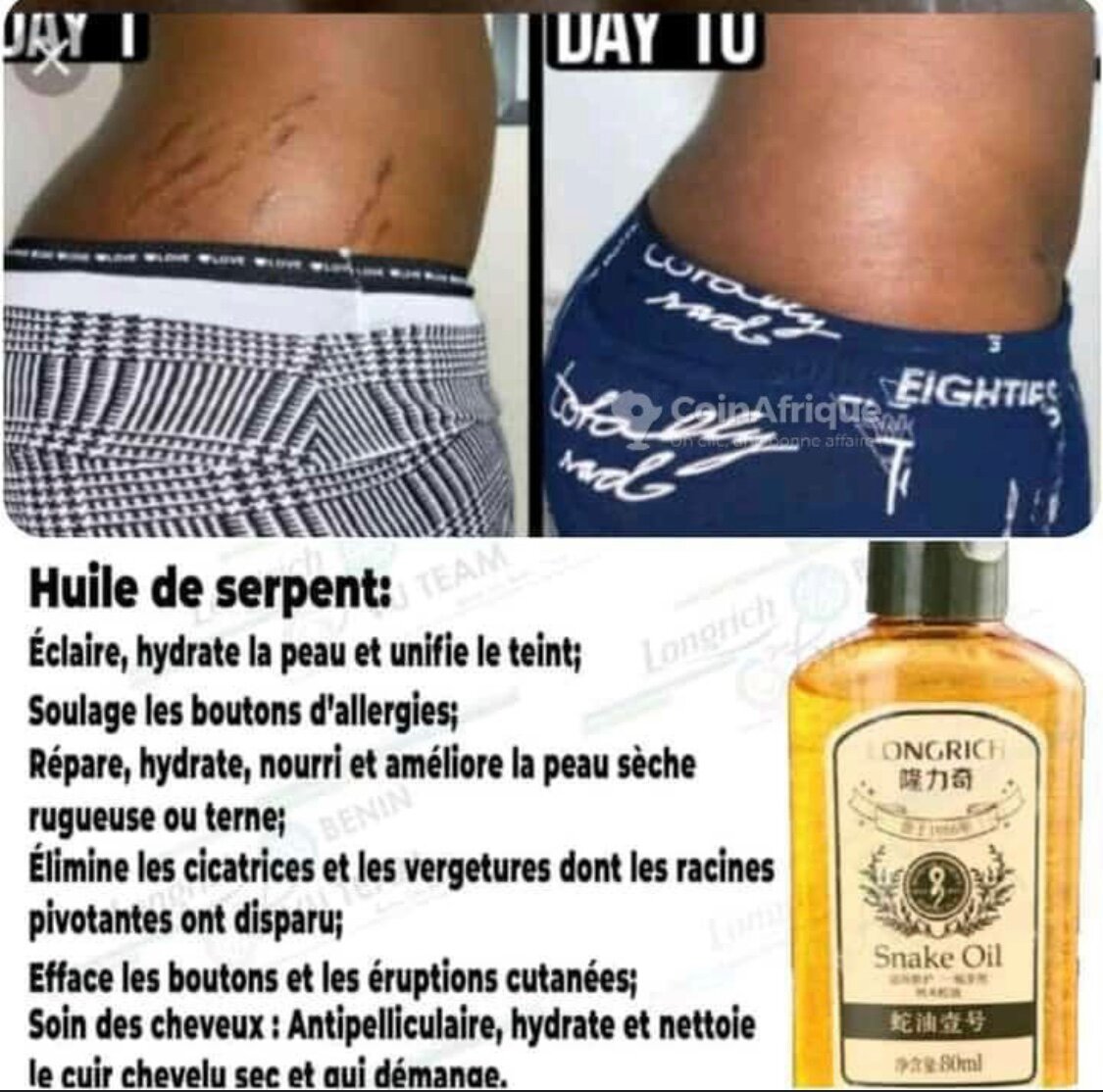 Huile de Serpent Longrich