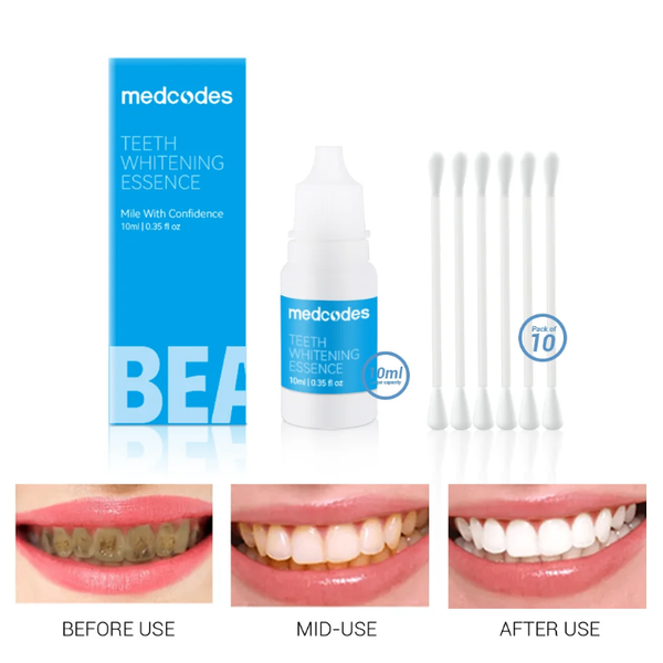 Essence Blanchiment Dentaire