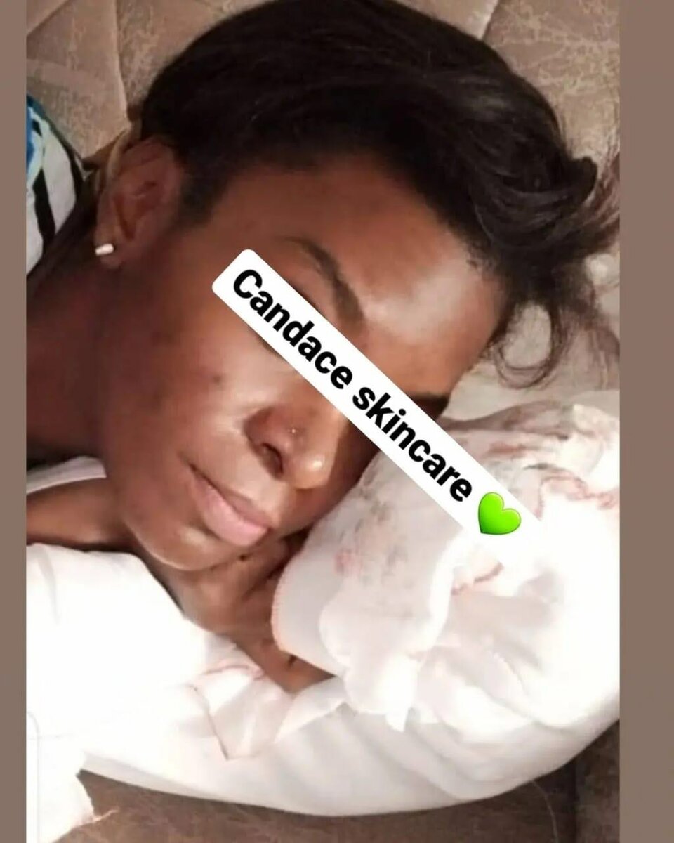 Pack anti imperfections