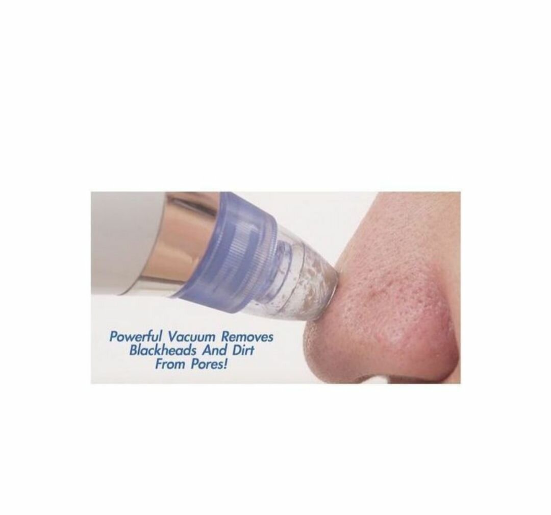 Aspirateur de graisse