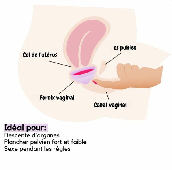 Disque menstruel reutilisable