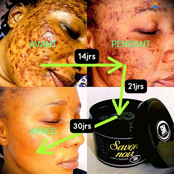 Savon noir anti-imperfections