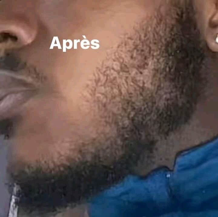 Huile de croissance pour la barbe