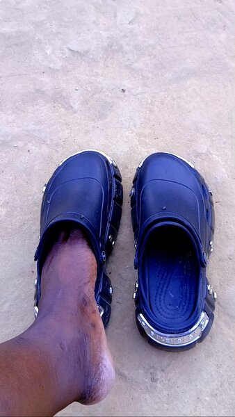 Sandales Clog Noires Résistantes