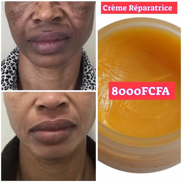 Crème Détachante Du Visage