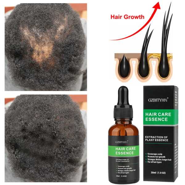 Essence Capillaire Anti-Chute