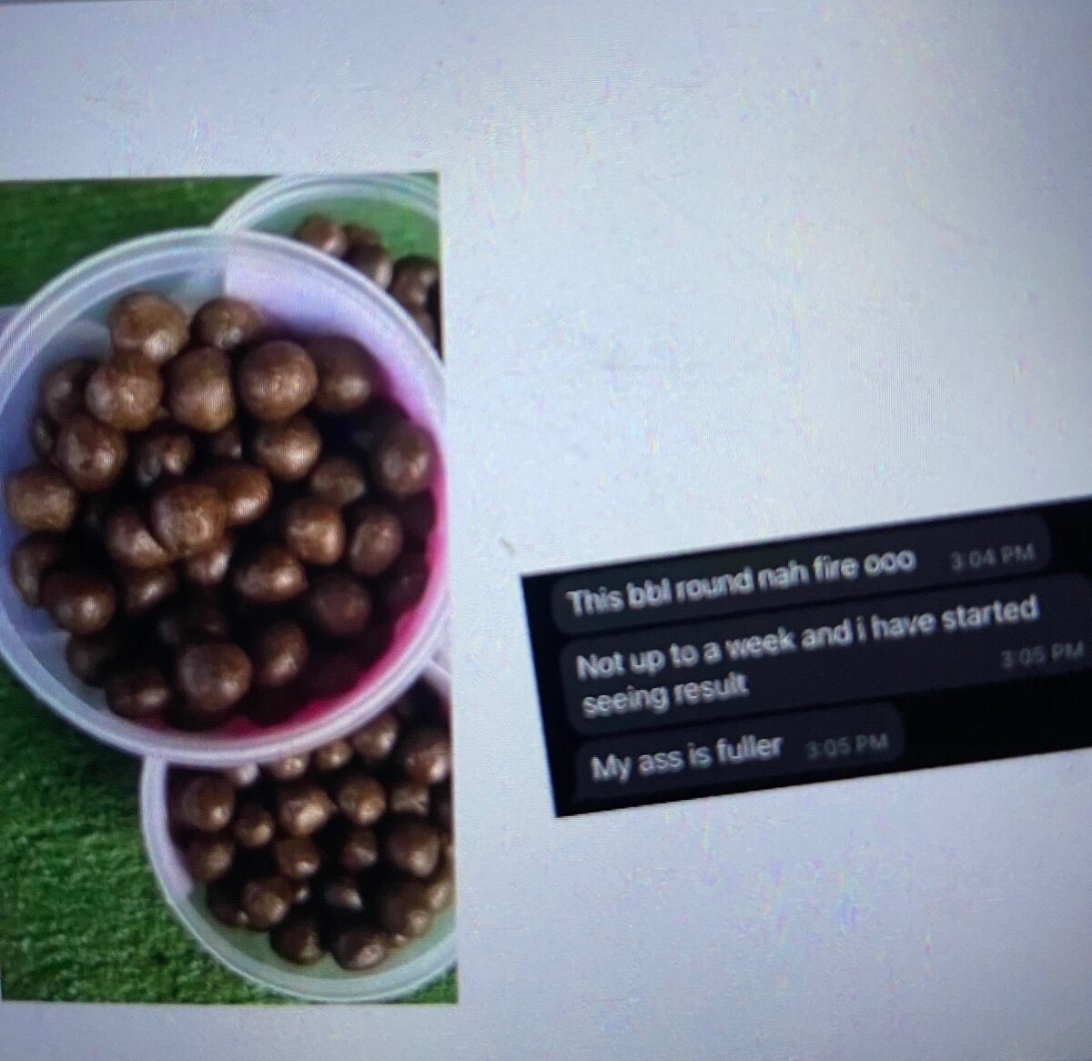 Butt suppository ball