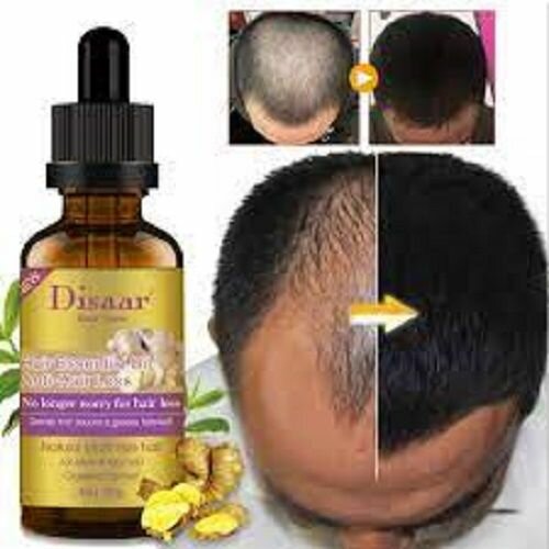 Disaar Natural Ginger Hair Care For Men And Women30ML-DS325-