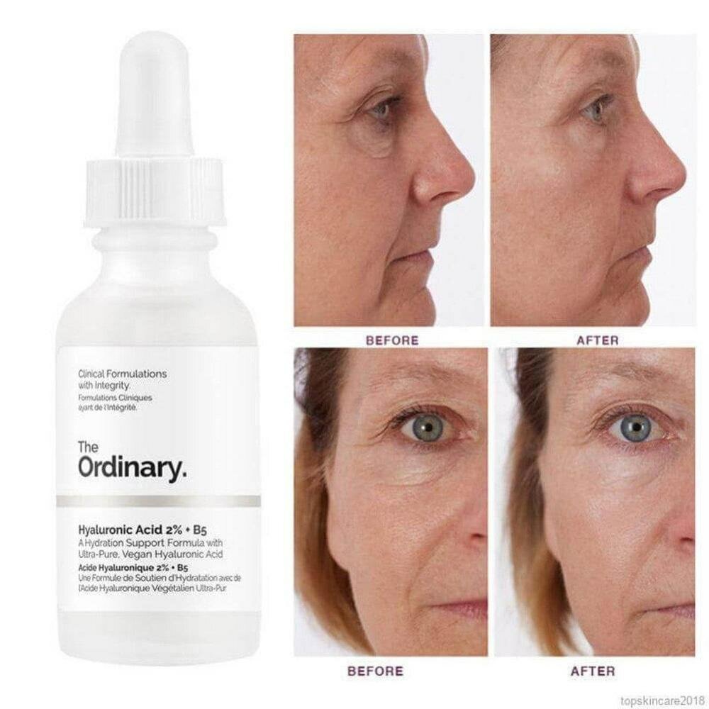 Hyaluronic Acid Hydrating Face Serum, 30 ML