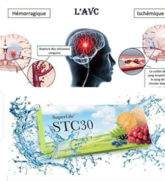 STC 30 Le Produit Miraculeux