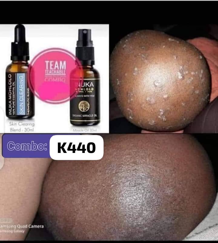 Skin clearing oils combo