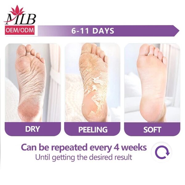 Masque Peel Pieds Anti-callosités