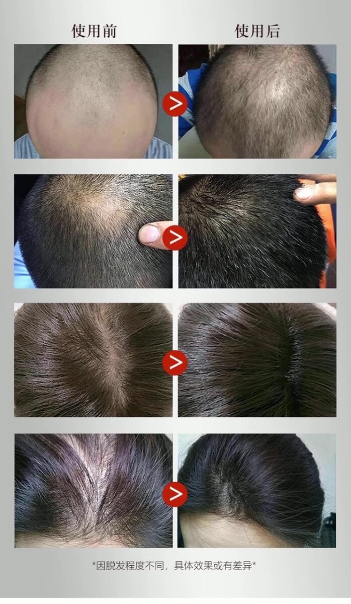 Натуральный шампунь из корня имбиря