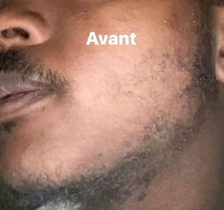 Huile de croissance pour la barbe