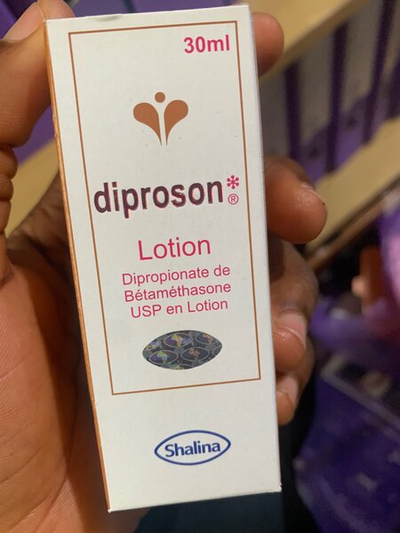 Diprosone lotion