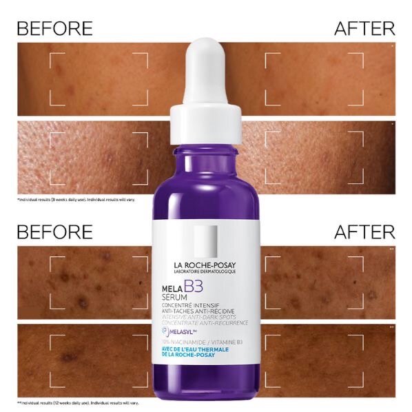 Mela B3 Sérum