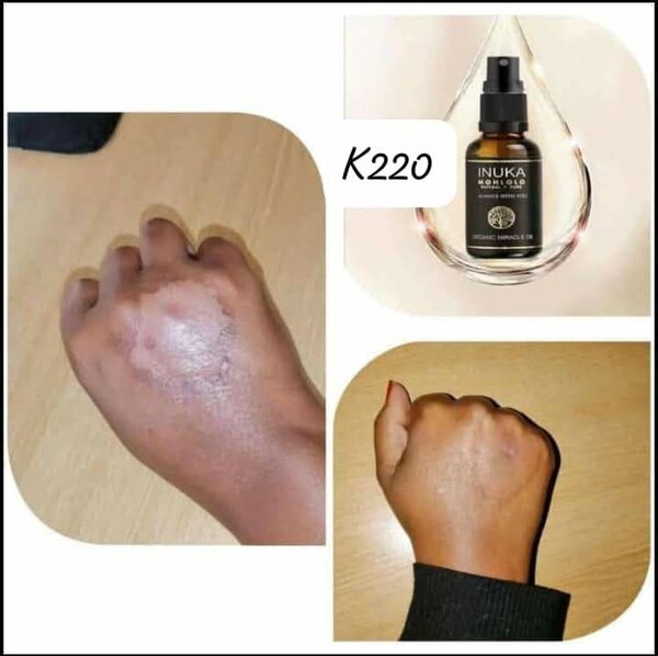 Miracle skin oil
