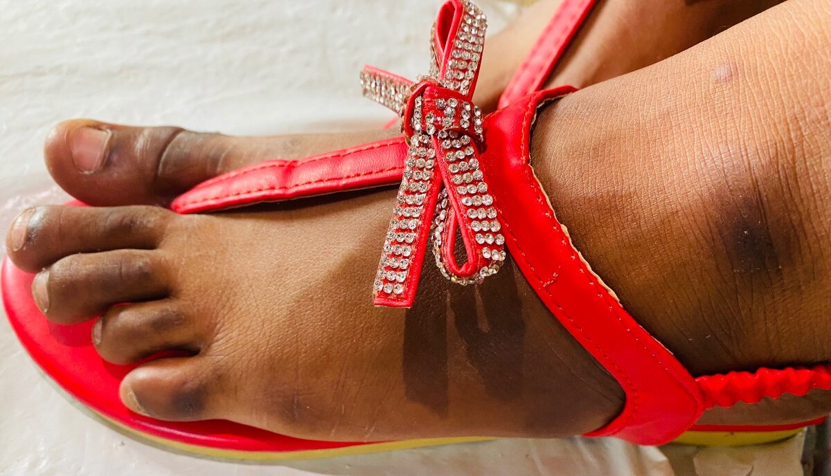 Sandales rouges brillantes