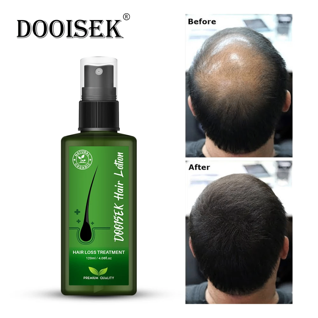 Dooisek Lotion Repousse Cheveux