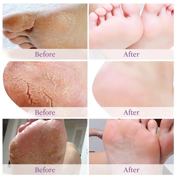 Foot mask