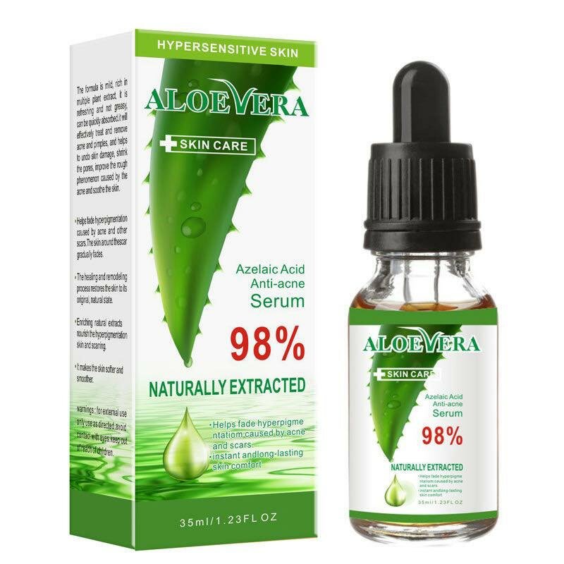 Aloe Vera facial acne remover serum