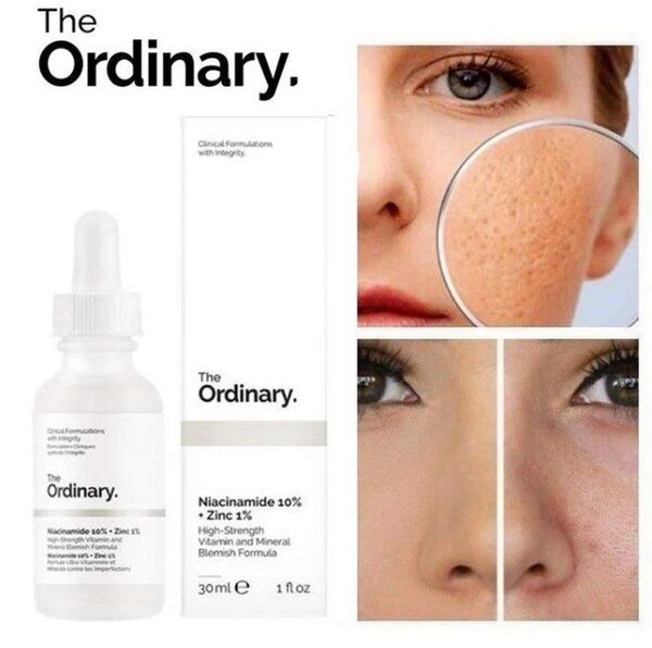 The Ordinary