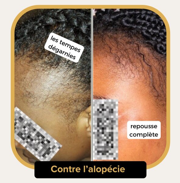 Secret de Pousse (30 ML)