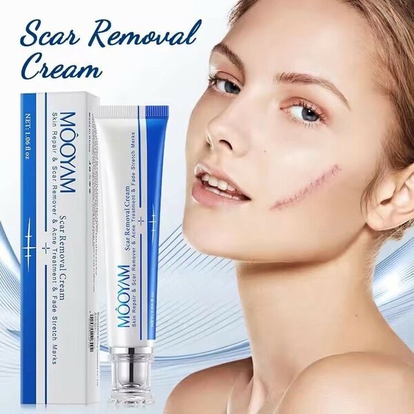 Scar remover cream