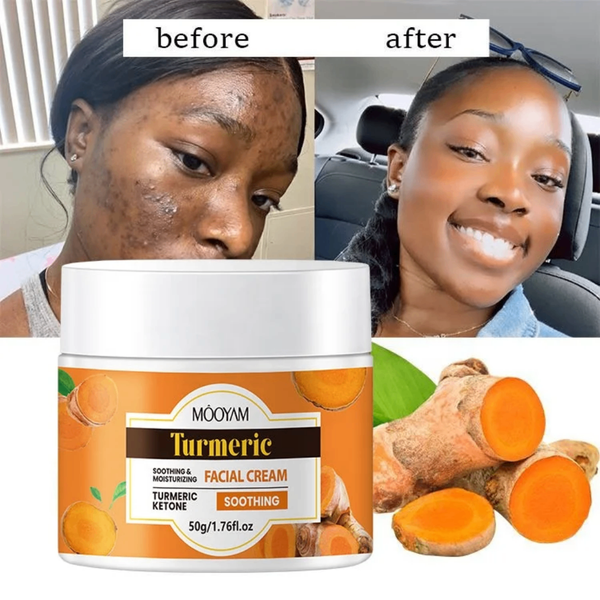 Crème Visage Apaisante Curcuma