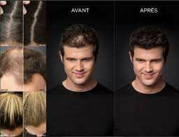 Toppik fibre capillaire