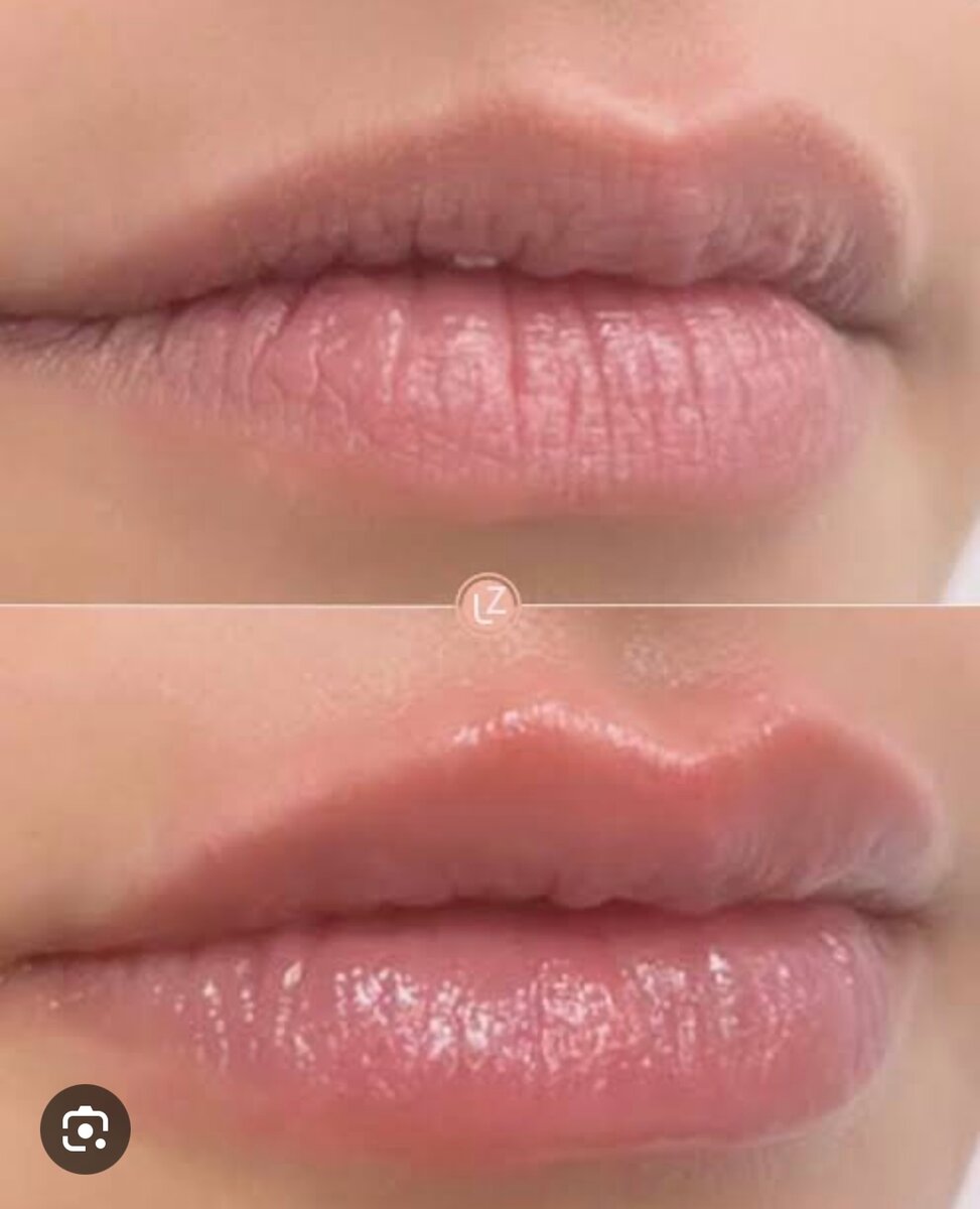 Baume Pur Cheri hydratante